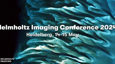 Volumetric Optical Flow Network for Digital Volume Correlation of Synchrotron Radiation-based Micro-CT Images of Bone-Implant Interfaces featured image