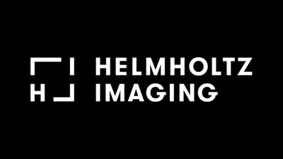 VolRAFTv2: Volumetric Optical Flow Network for Digital Volume Correlation featured image