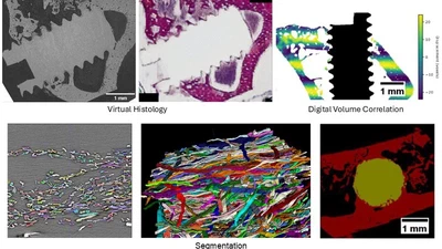 Machine Learning for the Reconstruction and Analysis of Synchrotron-radiation Tomography Data featured image